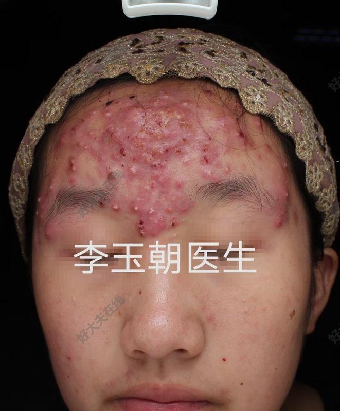 圖片