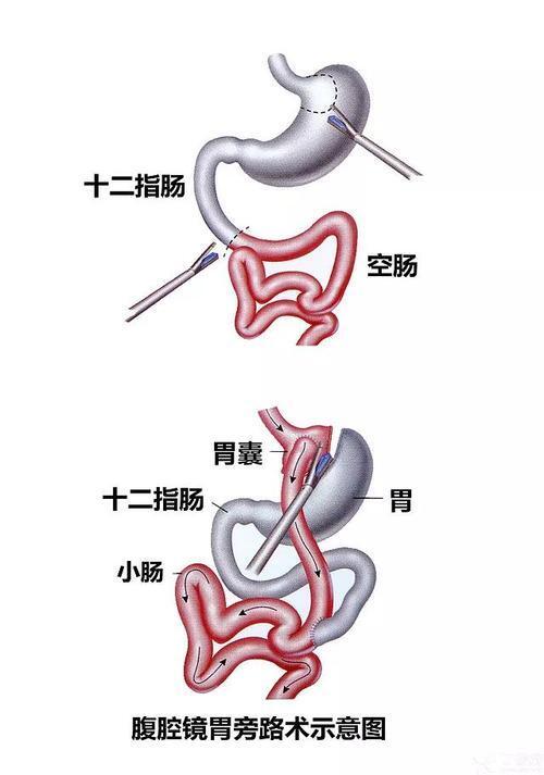 圖文圖片