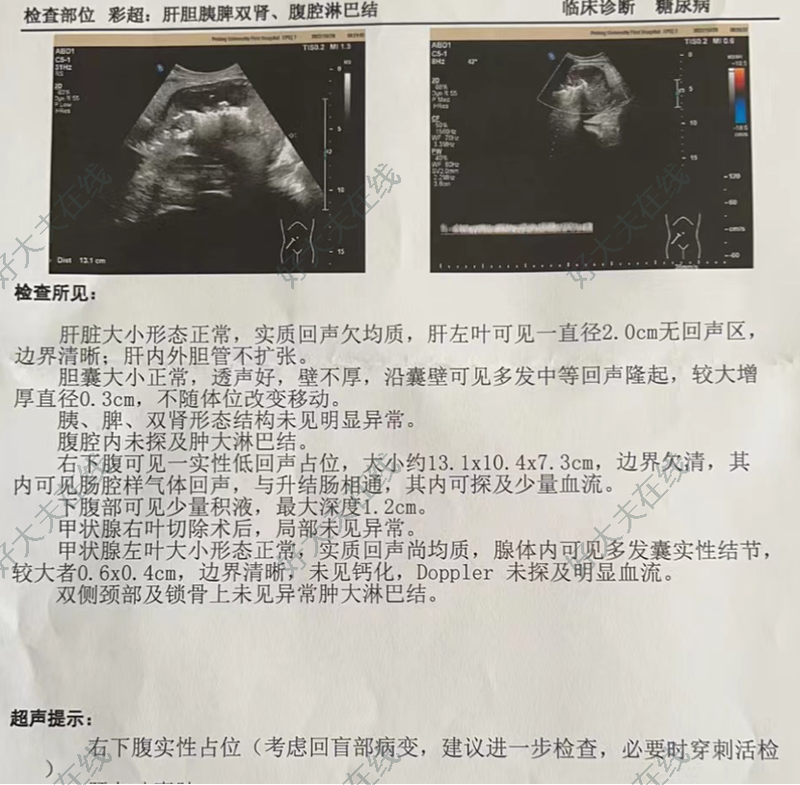 圖文圖片