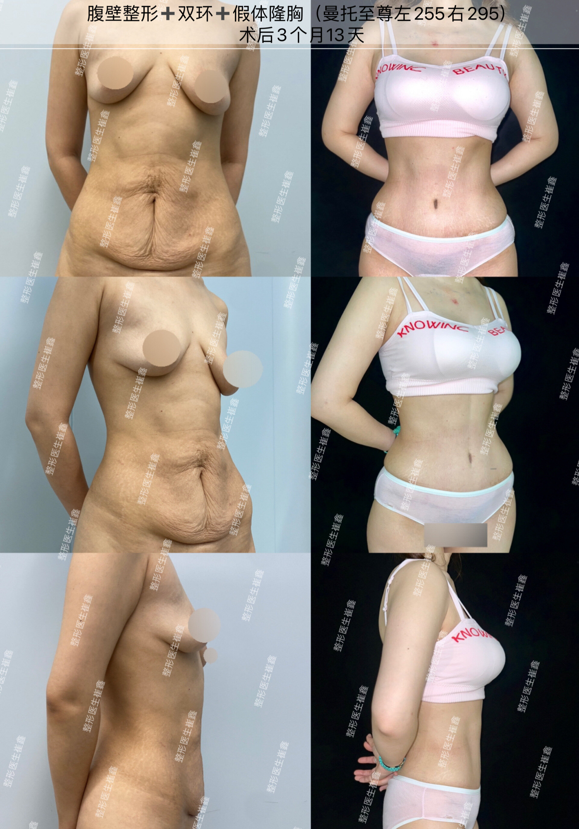 圖文圖片