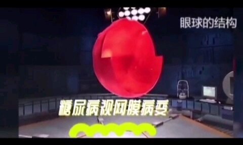 警惕！糖尿病视网膜病变偷走你的视力！
