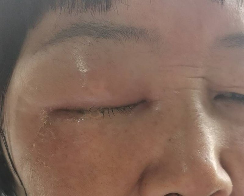 圖文圖片