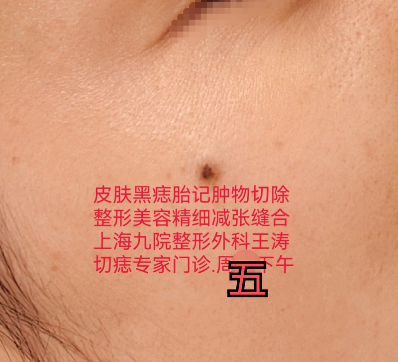 圖文圖片