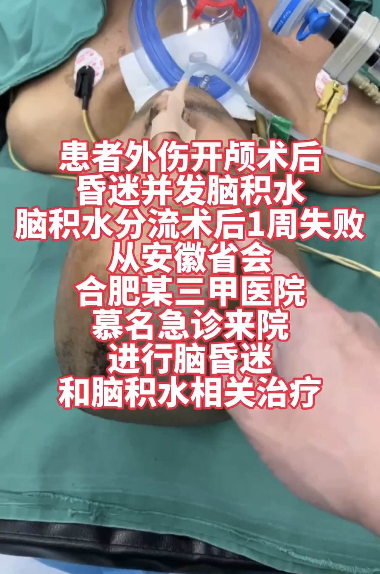 圖文圖片