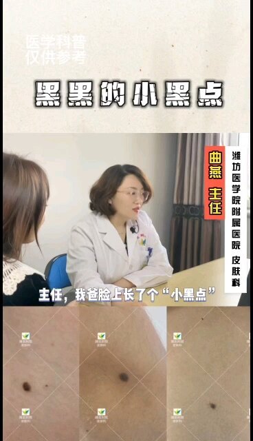 身上的黑点是不是黑素瘤呢？