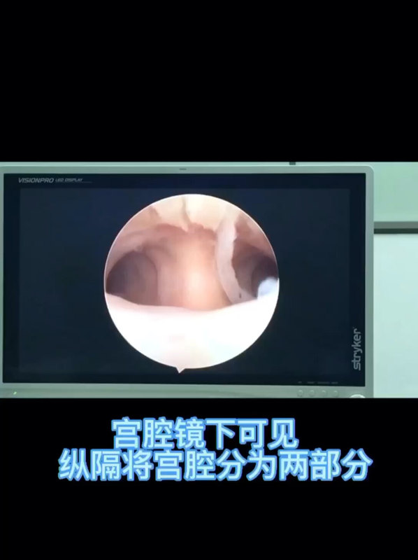 視頻封面