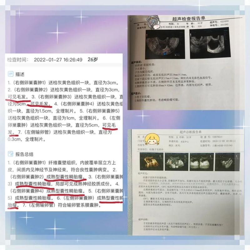 圖文圖片
