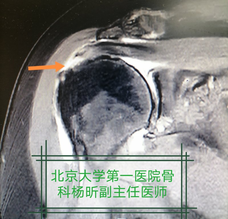 圖文圖片