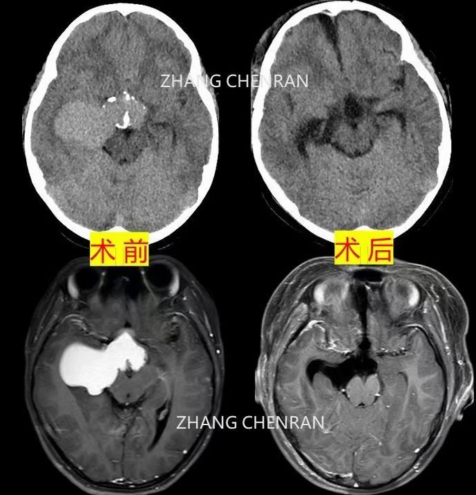 圖文圖片