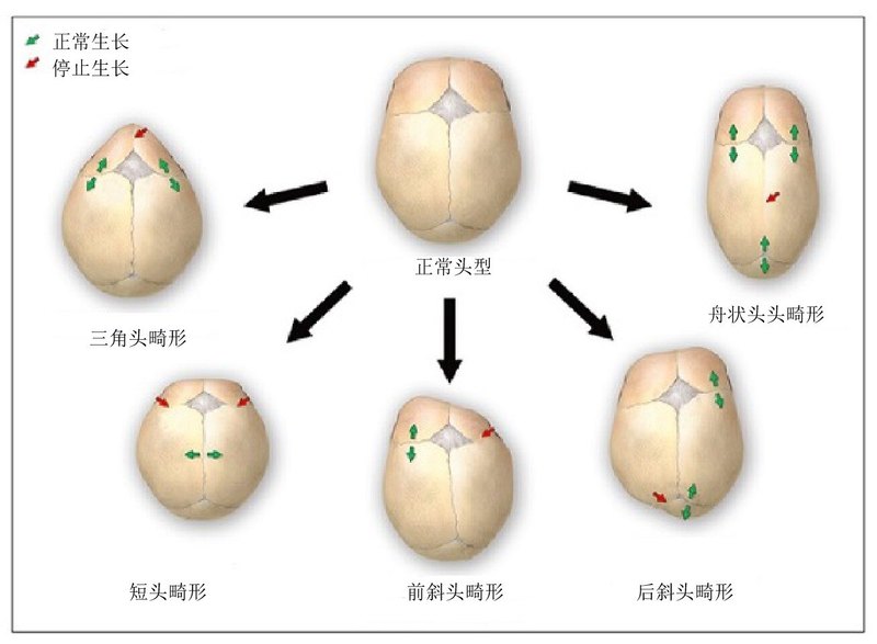 圖文圖片