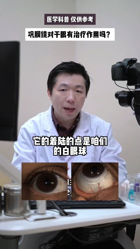 視頻封面
