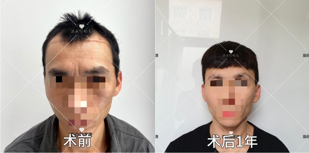圖文圖片