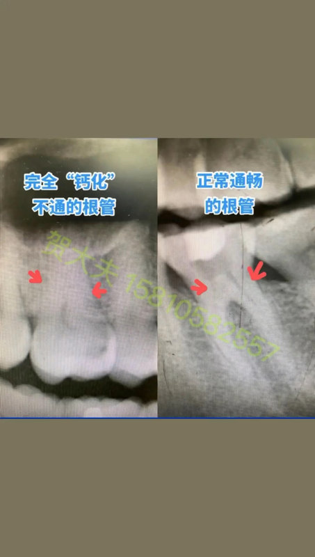 視頻封面