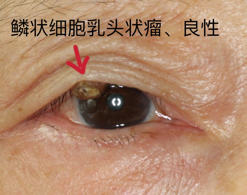 圖文圖片