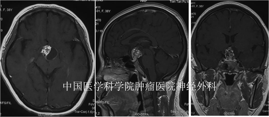 圖文圖片
