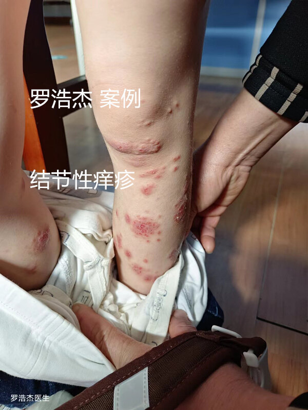 圖文圖片