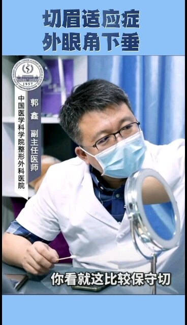 切眉适应症--外眼角下垂