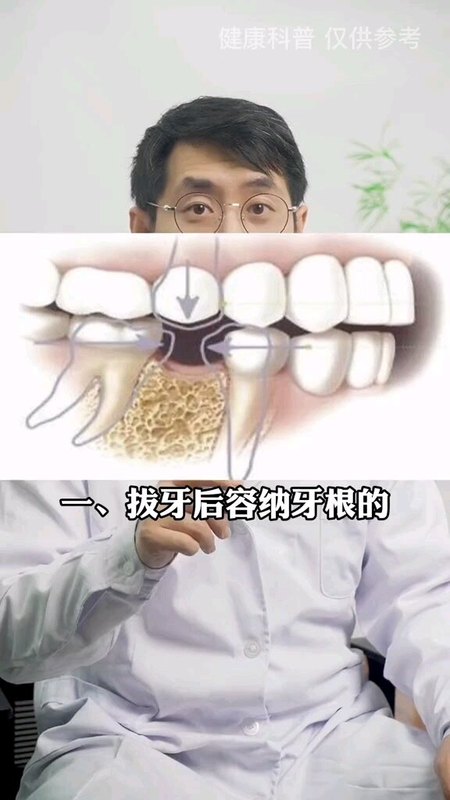 建议你不要随意拔牙