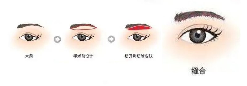 圖文圖片