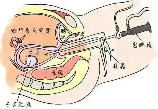 圖文圖片