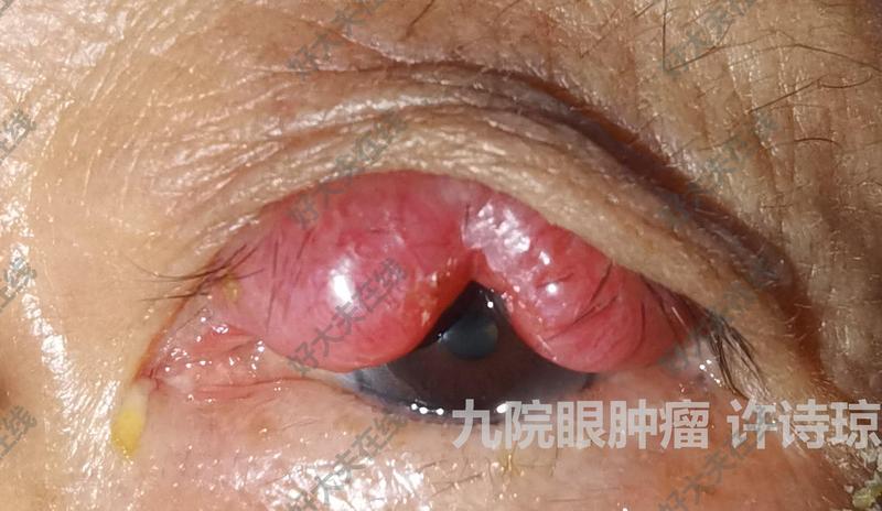 圖文圖片