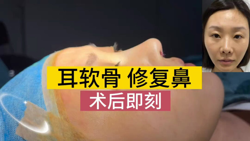 原来硅胶假体做完一年还能用吗？单纯硅胶假体做完了，不太满意，用耳软骨可以修复吗（有肖像权）