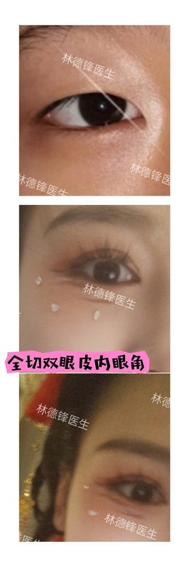 圖文圖片