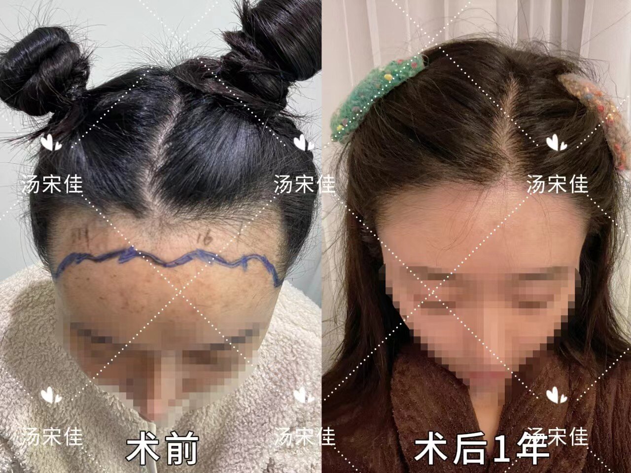 圖文圖片