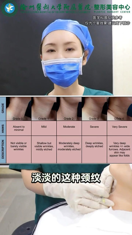 颈纹注射