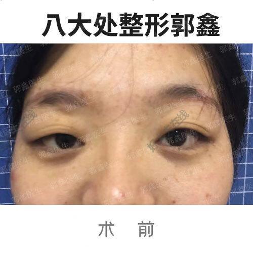 圖文圖片