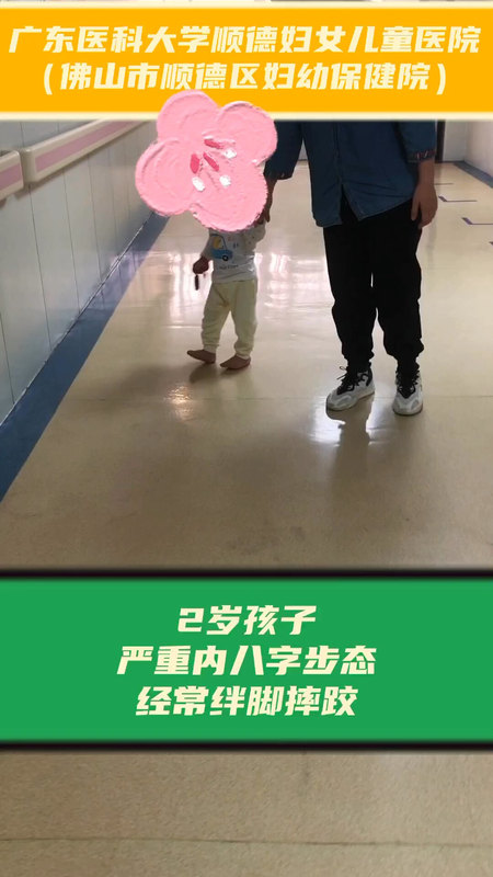 2岁孩子，严重内八字步态，经常绊脚摔跤，三个步骤判断出主要原因是大腿和小腿的内旋过大、而外旋不够。