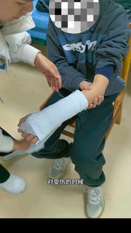前臂骨折后11天复查位置不好怎么办？要手术吗？
