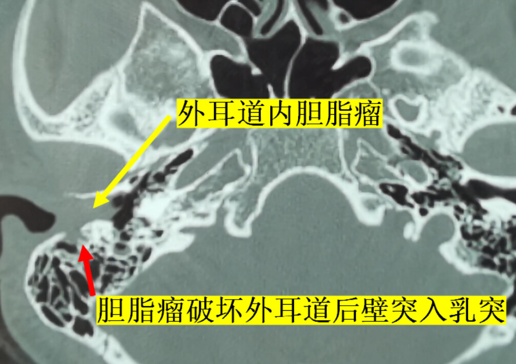 圖文圖片