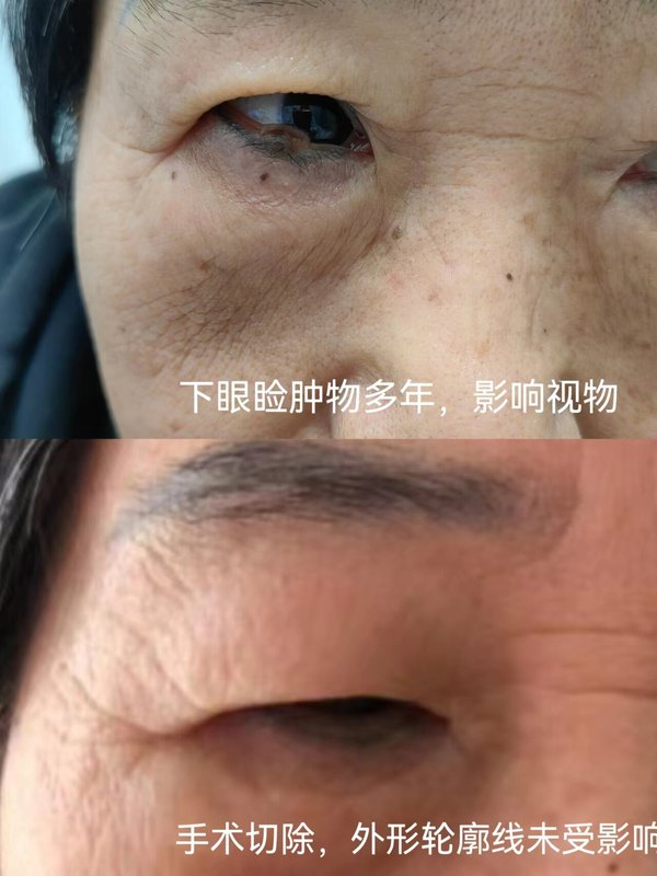 圖文圖片