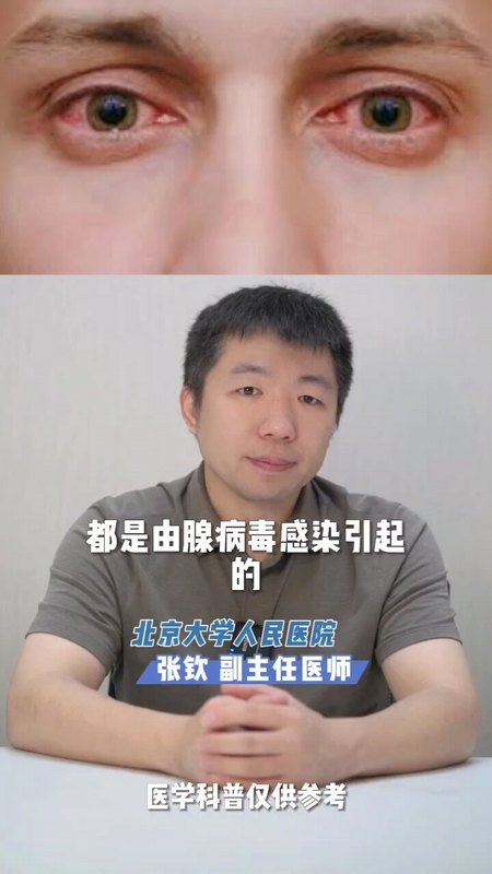 （2/4）红眼病会不会传染？怎么传染？传播 途径有哪些？如何预防?