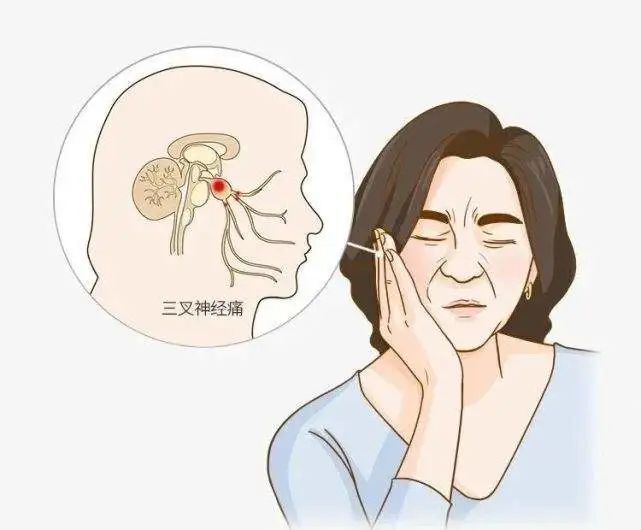 圖文圖片