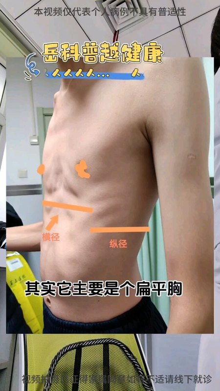 扁平胸，加强锻炼