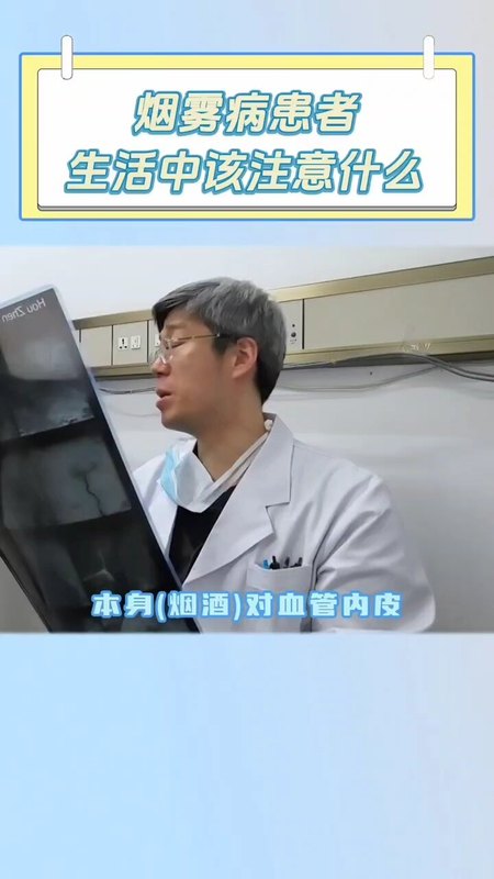 烟雾病患者生活中应该注意什么