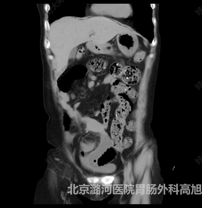 圖文圖片