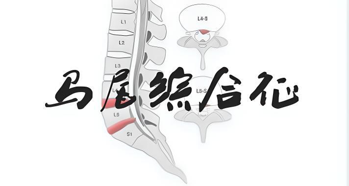 圖文圖片