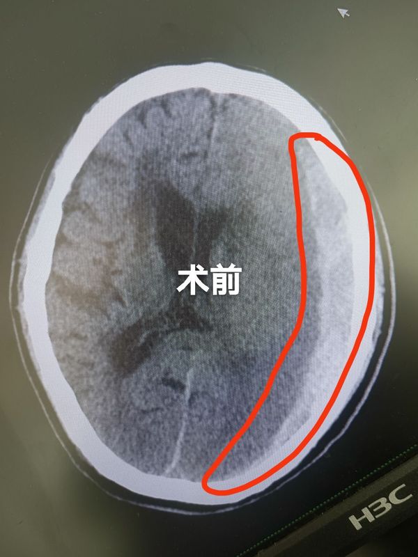 圖文圖片