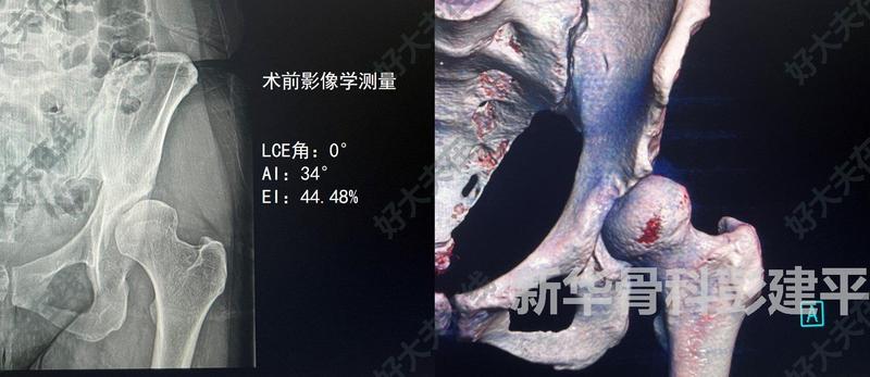 圖文圖片