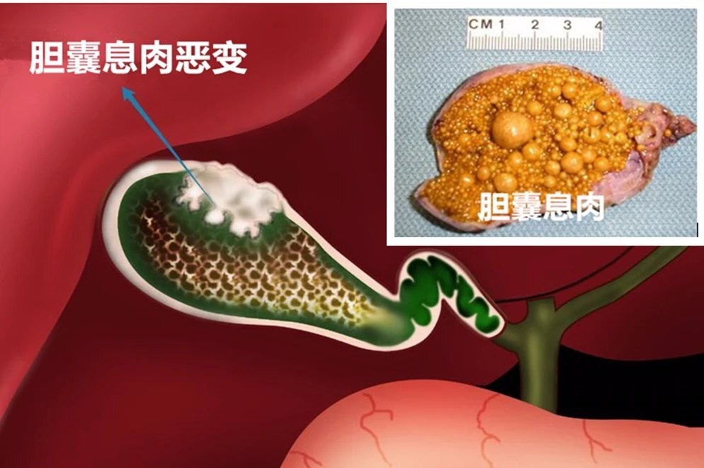 圖文圖片