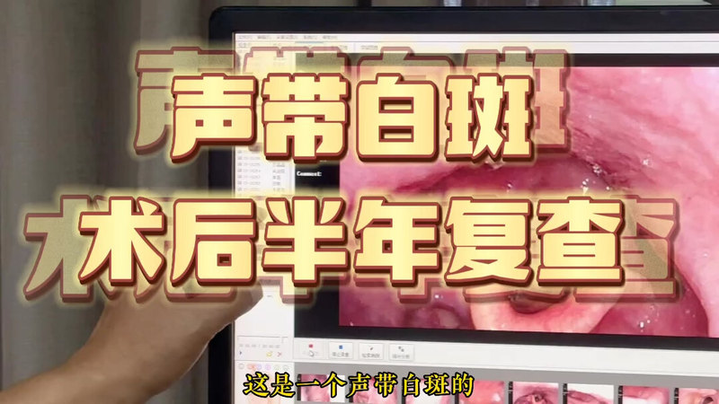 視頻封面