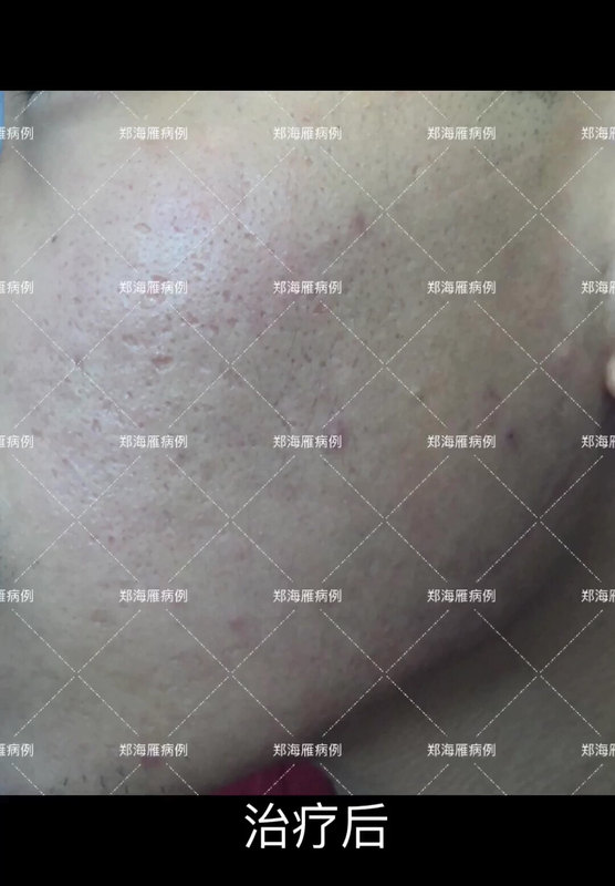 視頻封面