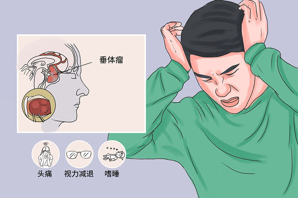 圖文圖片