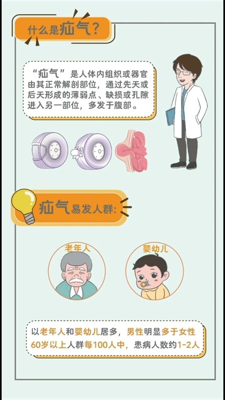不可忽视的疾病--腹股沟疝