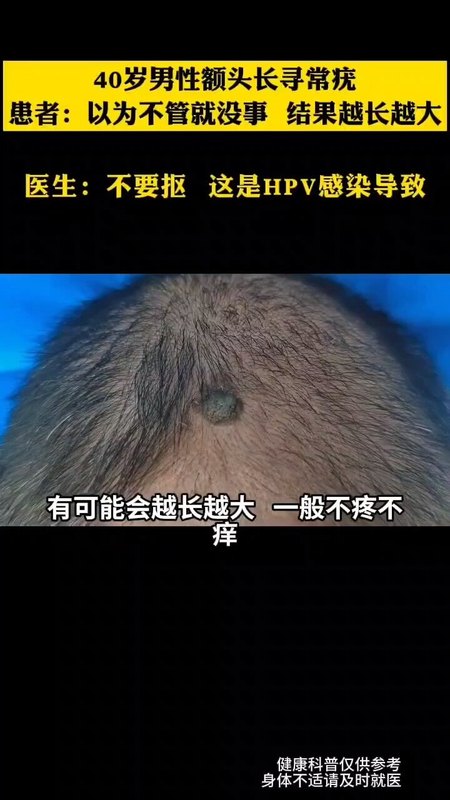 視頻封面
