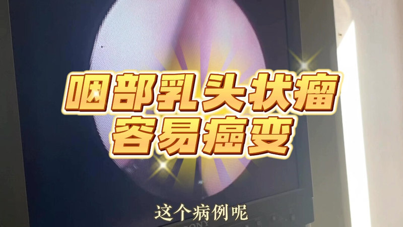 視頻封面