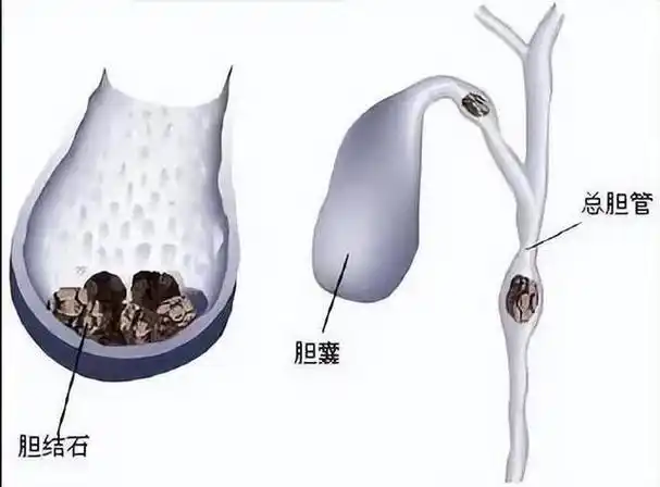 圖文圖片